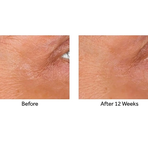 2x 15ml No7 Line Correcting Booster Serum Treatment for Fine Lines Wrinkles NEW - Picture 5 of 5